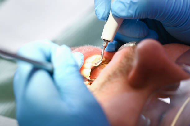 Best Emergency Wisdom Teeth Removal in Central Park, WA