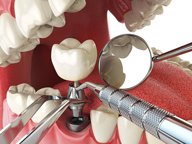 Best Weekend Emergency Dentist in Central Park, WA
